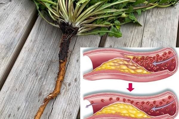 Kafa od korijena maslačka: 20 prednosti i kako je napraviti kod kuće