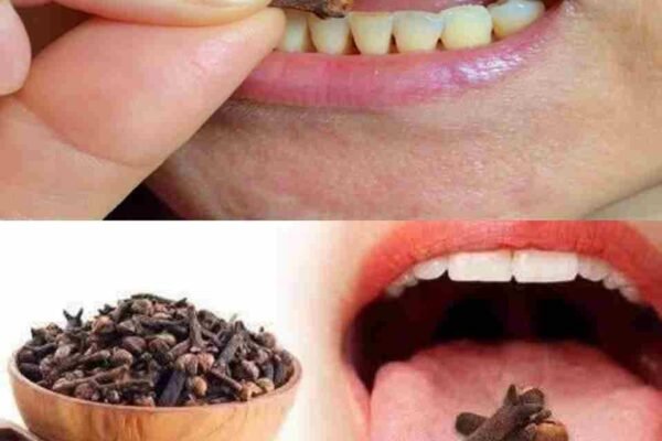 Karanfilić, poznat po svom jakom mirisu i ljekovitoj moći, pretvara se u prirodni tonik kada se potopi u vodi preko noći. Ova jednostavna, ali moćna tečnost bogata je antioksidansima, protivupalnim sastojcima i esencijalnim nutrijentima koji podržavaju tijelo i um. Redovno ispijanje vode od karanfilića može pomoći u jačanju imuniteta, poboljšanju probave i podizanju nivoa energije. Prirodno djeluje na unutrašnje procese organizma, čineći ga vitalnijim i otpornijim na svakodnevni stres. ✨ Prednosti koje poboljšavaju tvoje zdravlje: 1️⃣ Pomaže probavi – Stimuliše probavne enzime, ublažava gasove, nadutost i nelagodu. 2️⃣ Podržava oralno zdravlje – Uništava bakterije, osvježava dah i umiruje zubobolju. 3️⃣ Jača imunitet – Povećava prirodnu odbranu organizma i pomaže u sprječavanju infekcija. 4️⃣ Olakšava disajne tegobe – Smiruje kašalj, ublažava bol u grlu i čisti disajne puteve. 5️⃣ Poboljšava zdravlje kože – Antibakterijsko djelovanje smanjuje akne i nečistoće. 6️⃣ Reguliše nivo šećera u krvi – Poboljšava funkciju insulina i održava stabilnu energiju. 7️⃣ Smanjuje upale i bol u zglobovima – Eugenol pomaže u ublažavanju bola i održavanju pokretljivosti. 8️⃣ Podržava kontrolu tjelesne težine – Ubrzava metabolizam i smanjuje apetit. 🍃 Kako se priprema: Potopi 2 ili 3 karanfilića u čašu vode preko noći. Ujutro procijedi i popij na prazan želudac. Za jaču verziju, prokuhaj karanfiliće, pusti da se ohlade i pij dok je voda još topla. 💧 Zaključak: Voda od karanfilića je jednostavna, prirodna navika koja donosi brojne koristi za zdravlje, ravnotežu i svakodnevnu vitalnost. Dovoljno je samo nekoliko gutljaja dnevno da osjetiš razliku. 🌿✨